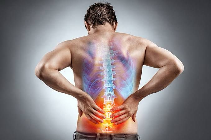 Ankylosing spondylitis treatment care with professional expert -MyoHeal Physiotherapy